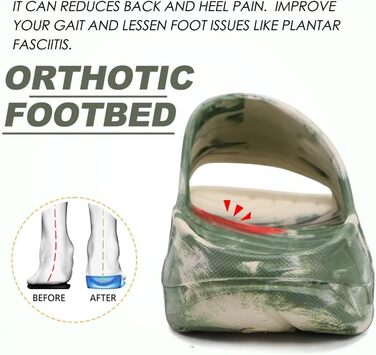 Чоловічі літні сандалі KuaiLu з підтримкою склепіння стопи, ортопедичні шльопанці від плоскостопості, зелені камуфляжні (40 EU)