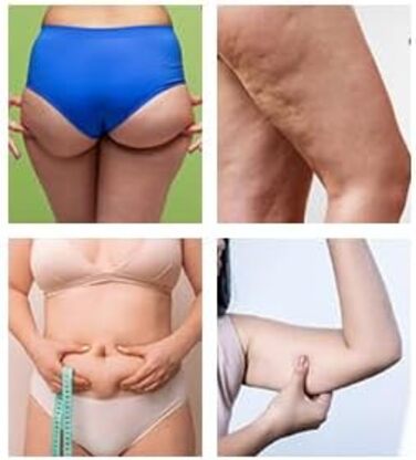 Гімнастичний тренажер Hyptonix для стегон та сідниць з еластичними гумками та сумкою – фітнес аксесуар для жінок, після пологів та реабілітації промежини, фіолетовий