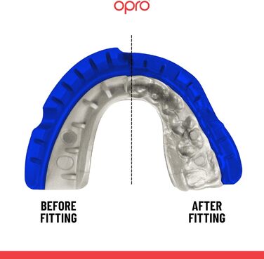 Захисна капа OPRO Gold для брекетів, спортивна капа для дорослих, інноваційна технологія підгонки, для боксу, лакросу, ММА, єдиноборств, хокею та контактних видів спорту, темно-синя/перламутрова