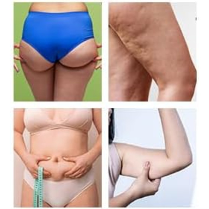 Гімнастичний тренажер Hyptonix для стегон та сідниць з еластичними гумками та сумкою – фітнес аксесуар для жінок, після пологів та реабілітації промежини, фіолетовий