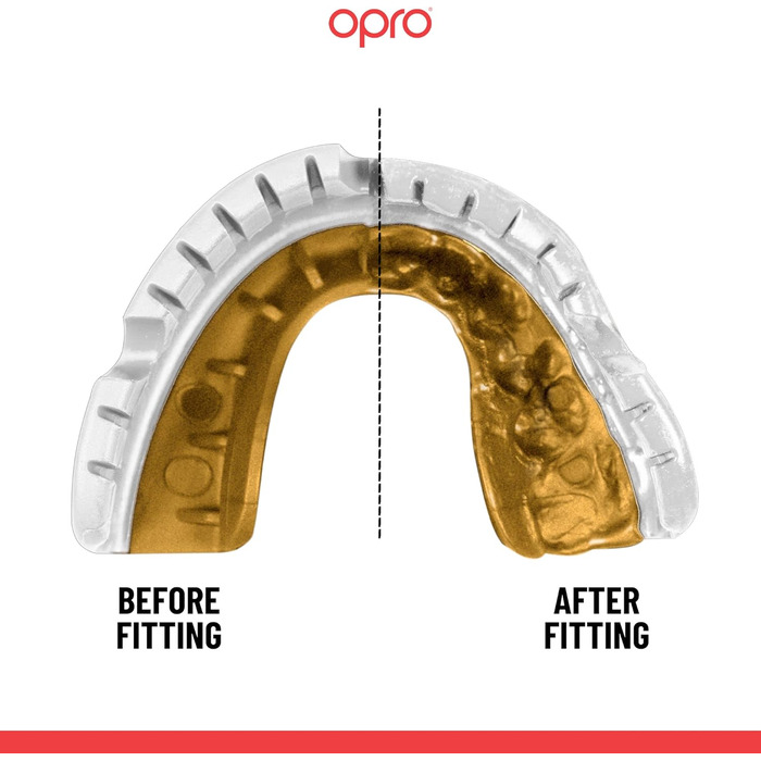 Захисна капа OPRO Gold для брекетів та спорту, для дорослих, з інноваційною технологією підгонки, для боксу, лакросу, ММА, єдиноборств, хокею та всіх контактних видів спорту, біло-золота