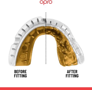 Захисна капа OPRO Gold для брекетів та спорту, для дорослих, з інноваційною технологією підгонки, для боксу, лакросу, ММА, єдиноборств, хокею та всіх контактних видів спорту, біло-золота